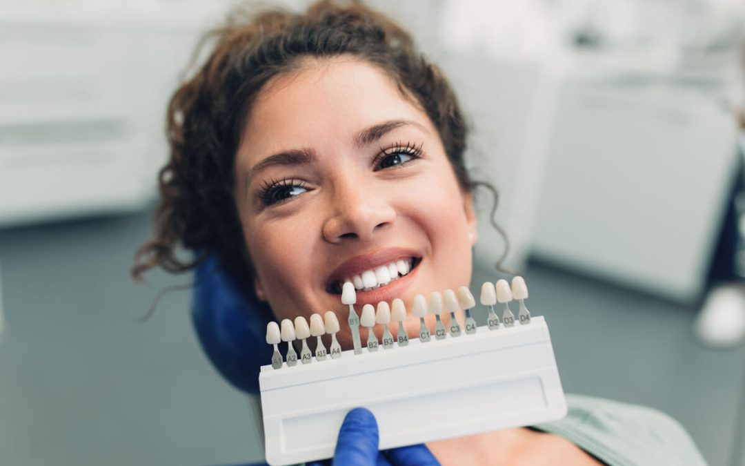 Do Veneers Ruin Your Teeth? A Professional Breakdown