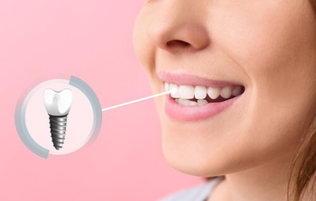cost of dental implants in australia results